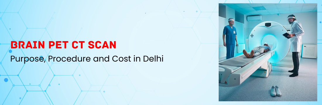 Brain PET CT Scan: Purpose, Procedure and Cost in Delhi